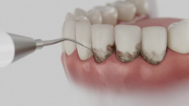 Trusted Emergency Dentist service in St. Elmo, IL - Dentist Open Now
